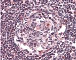 CCR5 Antibody in Immunohistochemistry (IHC)