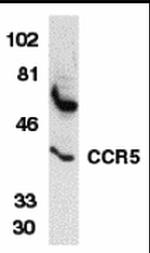 CCR5 Antibody in Western Blot (WB)