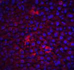 FLIP Antibody in Immunohistochemistry (IHC)