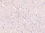 CIDEA Antibody in Immunohistochemistry (IHC)