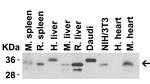 MyD88 Antibody in Western Blot (WB)