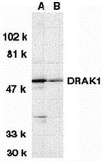 DRAK1 Antibody in Western Blot (WB)