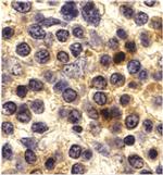 CX3CR1 Antibody in Immunohistochemistry (IHC)