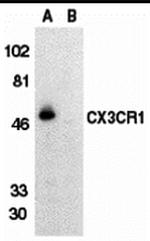 CX3CR1 Antibody in Western Blot (WB)