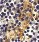 DC-SIGN Antibody in Immunohistochemistry (IHC)