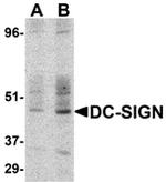 DC-SIGN Antibody in Western Blot (WB)