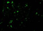 TCCR Antibody in Immunocytochemistry (ICC/IF)