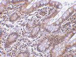 Livin Antibody in Immunohistochemistry (IHC)