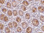 AATF Antibody in Immunohistochemistry (IHC)