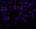 PUMA alpha Antibody in Immunocytochemistry (ICC/IF)