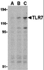 TLR7 Antibody in Western Blot (WB)