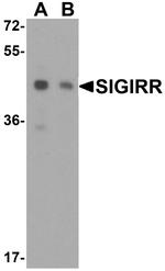 SIGIRR Antibody in Western Blot (WB)
