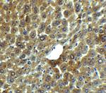 LAMP2 Antibody in Immunohistochemistry (IHC)