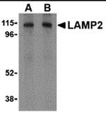 LAMP2 Antibody in Western Blot (WB)