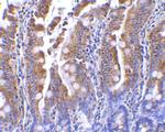 PIST Antibody in Immunohistochemistry (IHC)