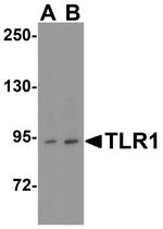 TLR1 Antibody in Western Blot (WB)