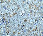 Apolipoprotein J Antibody in Immunohistochemistry (IHC)