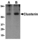 Apolipoprotein J Antibody in Western Blot (WB)