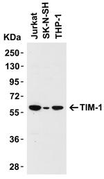 TIM-1 Antibody in Western Blot (WB)