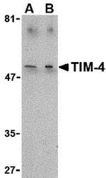 TIMD4 Antibody in Western Blot (WB)