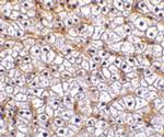 CD266 Antibody in Immunohistochemistry (IHC)