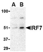 IRF7 Antibody in Western Blot (WB)