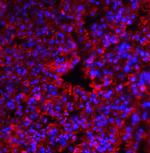 PKR Antibody in Immunohistochemistry (Paraffin) (IHC (P))