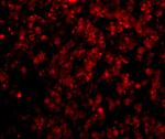 HSL Antibody in Immunocytochemistry (ICC/IF)