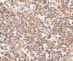 HSL Antibody in Immunohistochemistry (IHC)