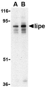 HSL Antibody in Western Blot (WB)