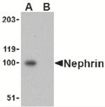 Nephrin Antibody in Western Blot (WB)