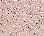 Stathmin 1 Antibody in Immunohistochemistry (Paraffin) (IHC (P))