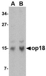 Stathmin 1 Antibody in Western Blot (WB)