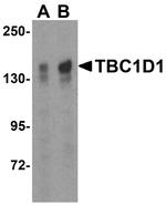 TBC1D1 Antibody in Western Blot (WB)