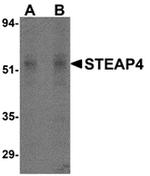 STEAP4 Antibody in Western Blot (WB)