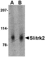 SLITRK2 Antibody in Western Blot (WB)