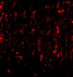 SATB2 Antibody in Immunocytochemistry (ICC/IF)