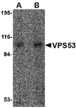 VPS53 Antibody in Western Blot (WB)