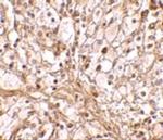 TRIM30 Antibody in Immunohistochemistry (IHC)