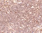 S1P1 Antibody in Immunohistochemistry (IHC)