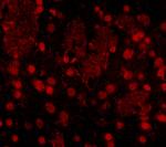 FTO Antibody in Immunocytochemistry (ICC/IF)