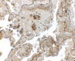 Transthyretin Antibody in Immunohistochemistry (IHC)