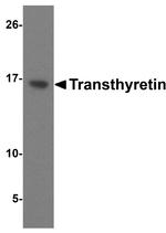 Transthyretin Antibody in Western Blot (WB)