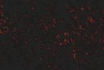 LDLR Antibody in Immunohistochemistry (IHC)