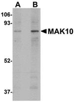 MAK10 Antibody in Western Blot (WB)