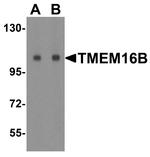 TMEM16B Antibody in Western Blot (WB)
