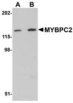 MYBPC2 Antibody in Western Blot (WB)