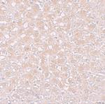 AFP Antibody in Immunohistochemistry (IHC)