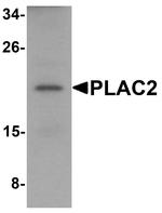 PLAC2 Antibody in Western Blot (WB)