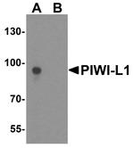 PIWIL1 Antibody in Western Blot (WB)